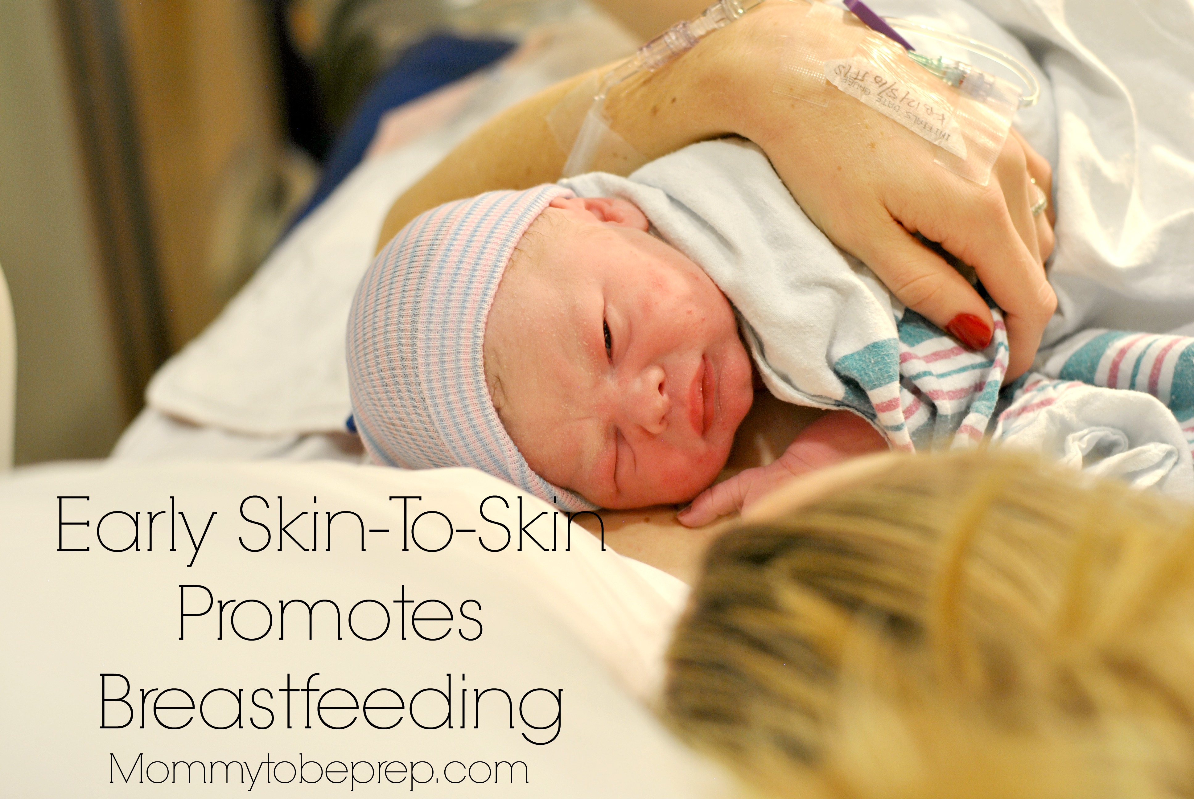 Early Skin-to-skin Promotes Breastfeeding