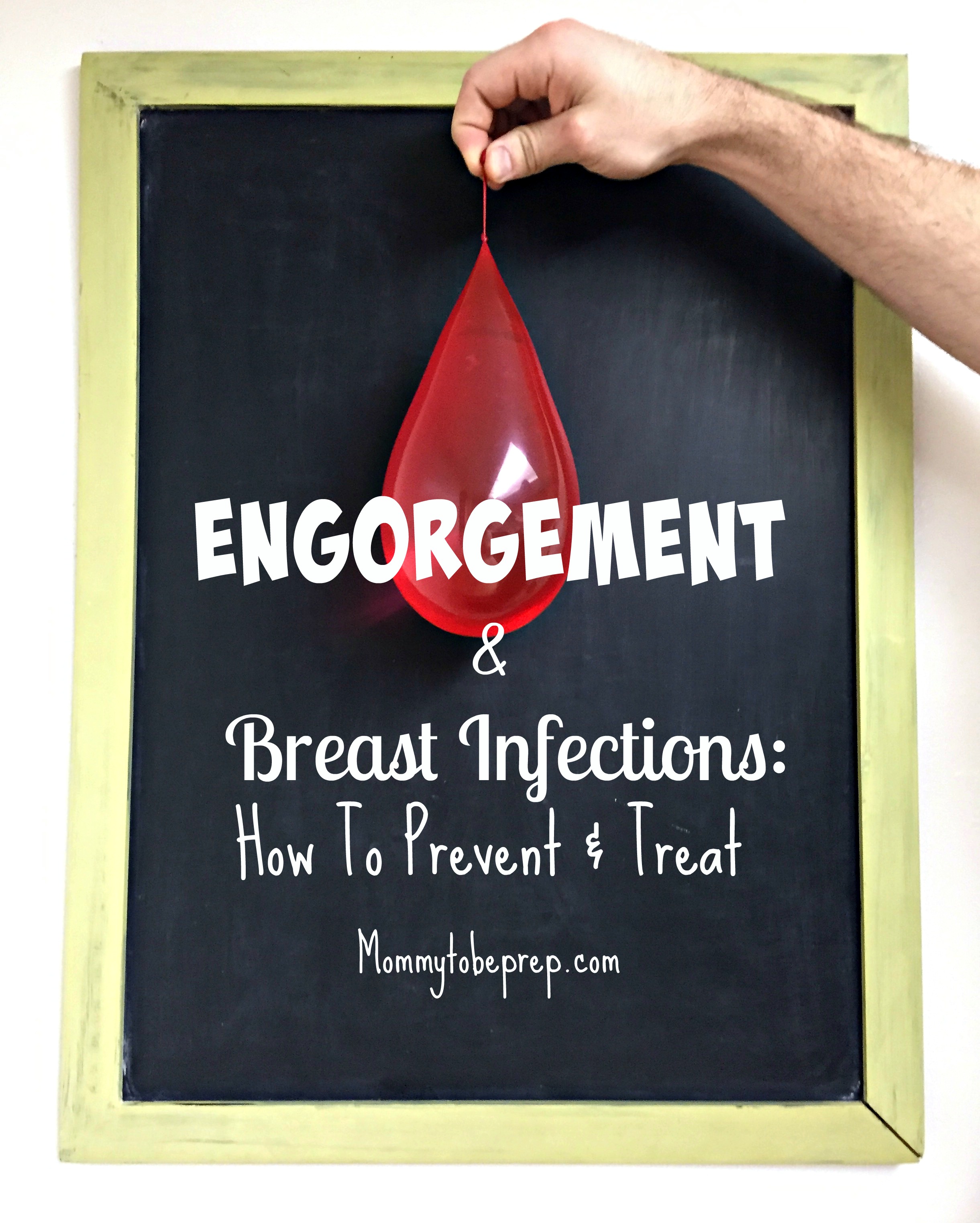 Engorgement And Acute Mastitis How To Prevent And Treat Mommy To Be Prep