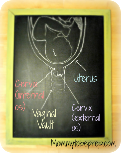 Where is the cervix?