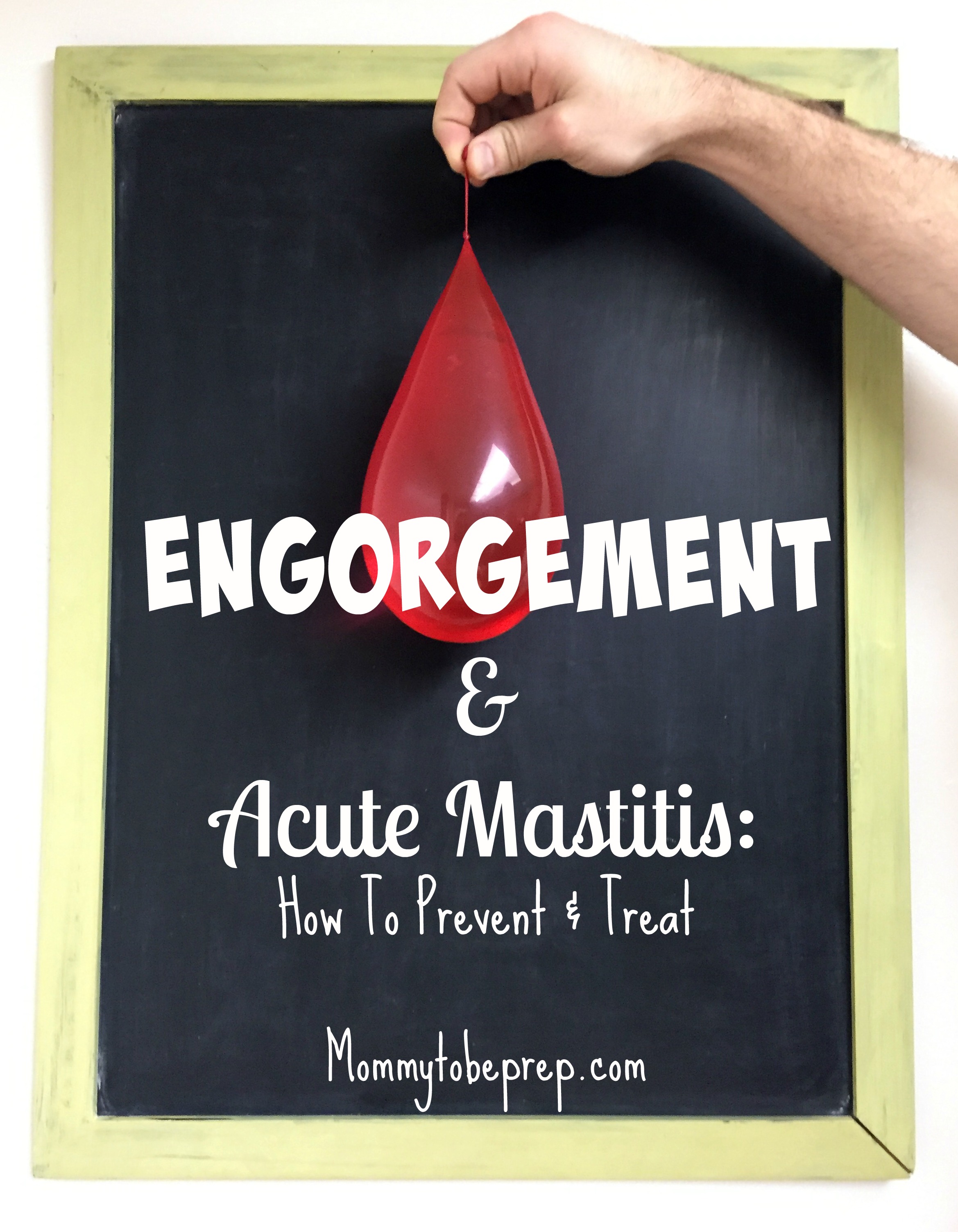 Engorgement & Acute Mastitis: How to Prevent & Treat