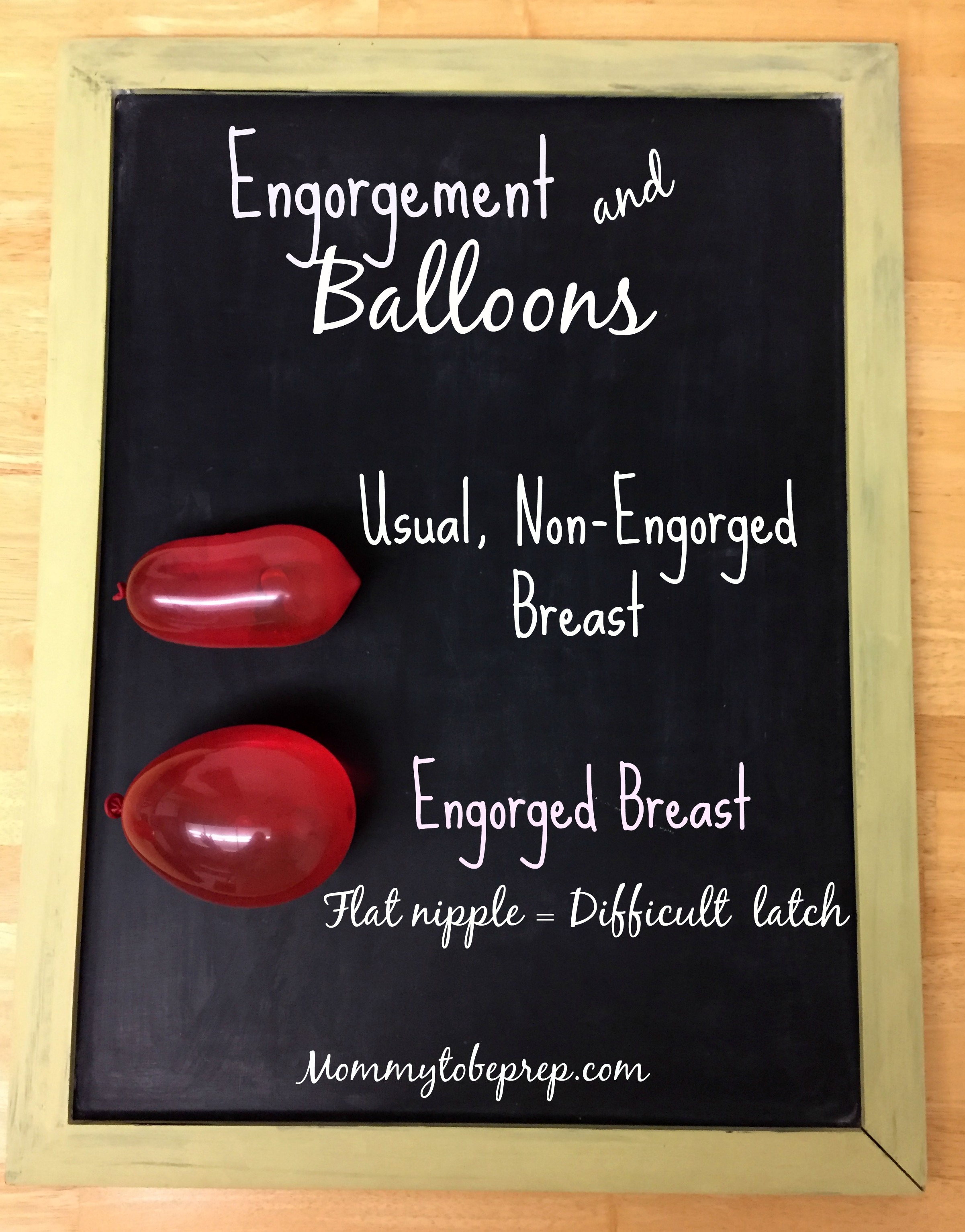 engorgement and balloons